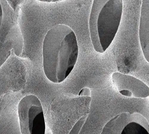 Siliziumkarbid-Schaumstofffilter Mikroskopisches Bild